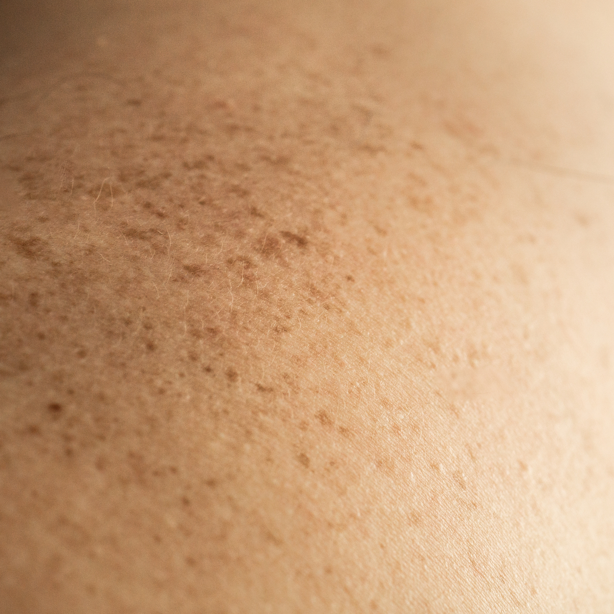 close up view of skin texture and freckles