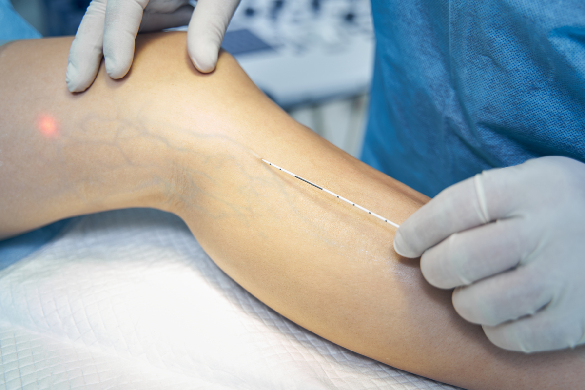 closeup of an injection into the vein on a leg