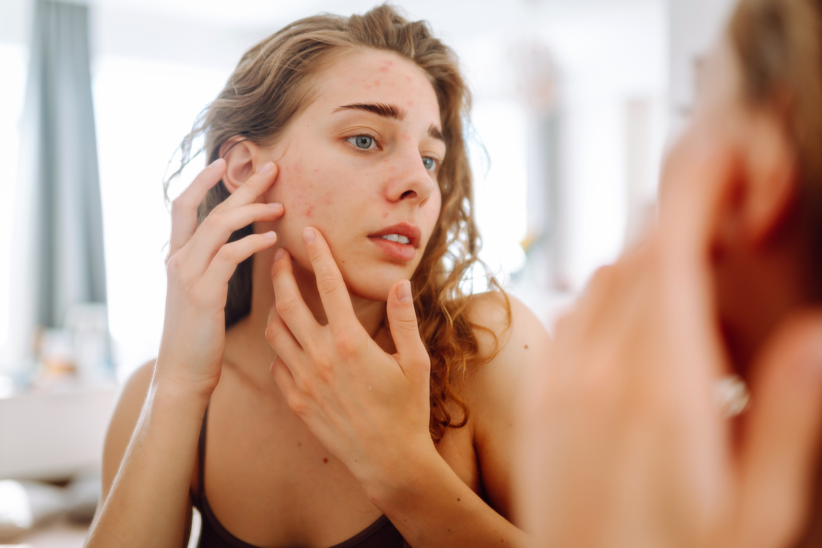 woman looking in mirror looking at acne on her face